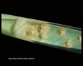 m.tuberculosis colonies on L�wenstein-Jensen medium